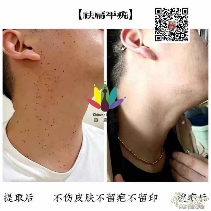 https://att.huarenjie.com/attachment/information/20260220/1771574749901664.jpg