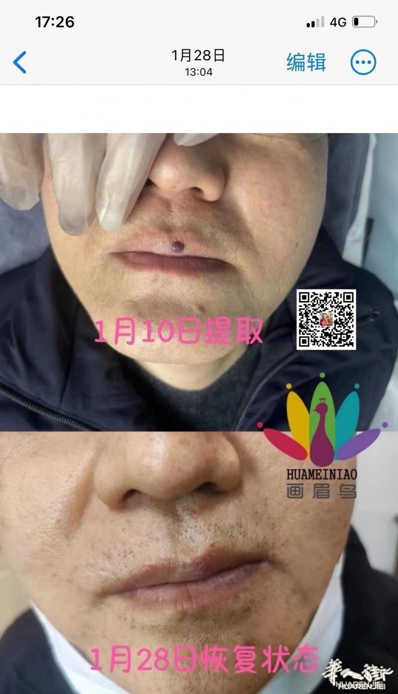 https://att.huarenjie.com/attachment/information/20260220/1771574774559710.jpg