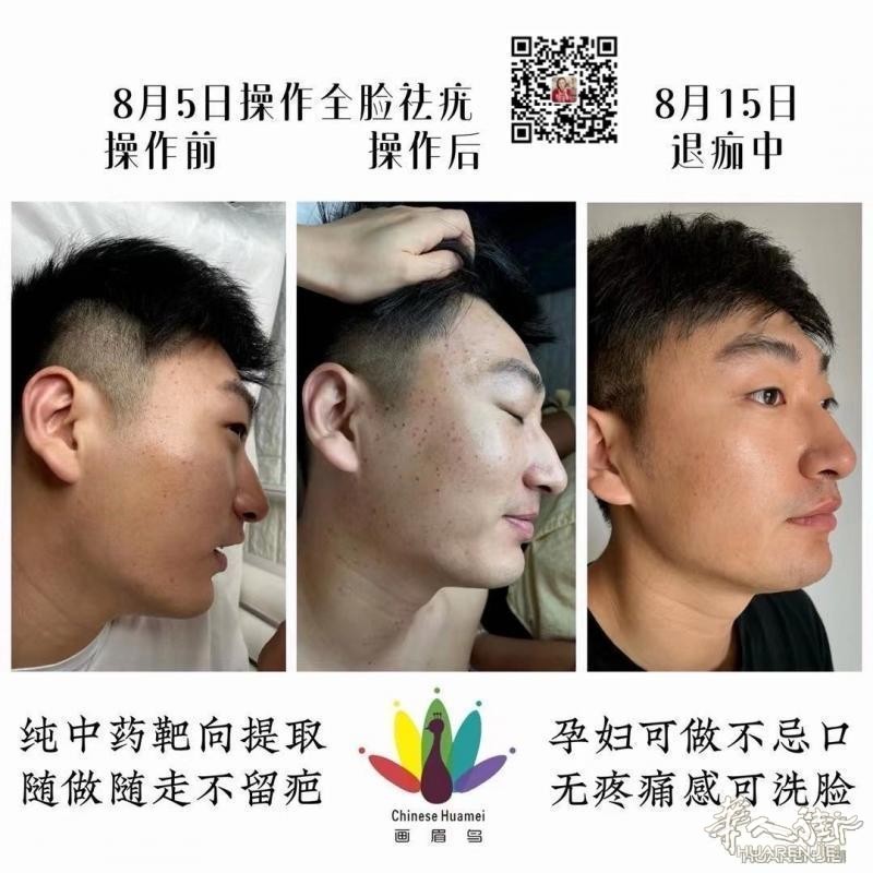 https://att.huarenjie.com/attachment/information/20260220/1771574794314160.jpg