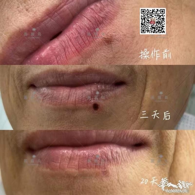 https://att.huarenjie.com/attachment/information/20260220/1771574798139005.jpg