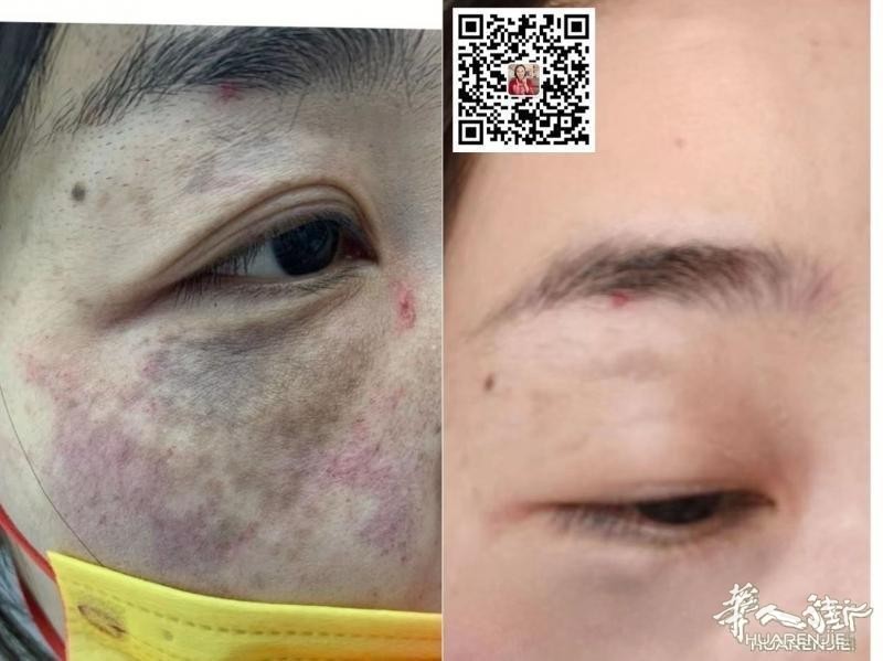 https://att.huarenjie.com/attachment/information/20260220/1771574846266925.jpg