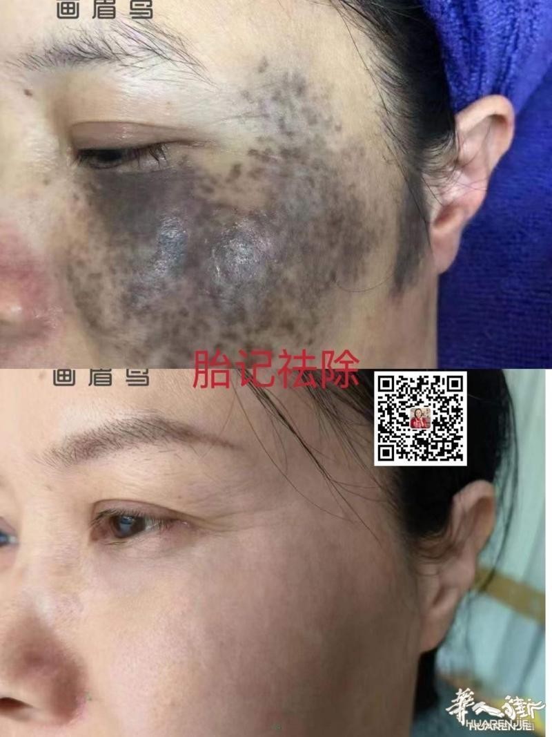 https://att.huarenjie.com/attachment/information/20260220/1771574830535247.jpg