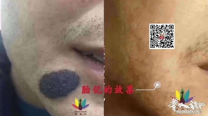 https://att.huarenjie.com/attachment/information/20260220/1771574849276735.jpg