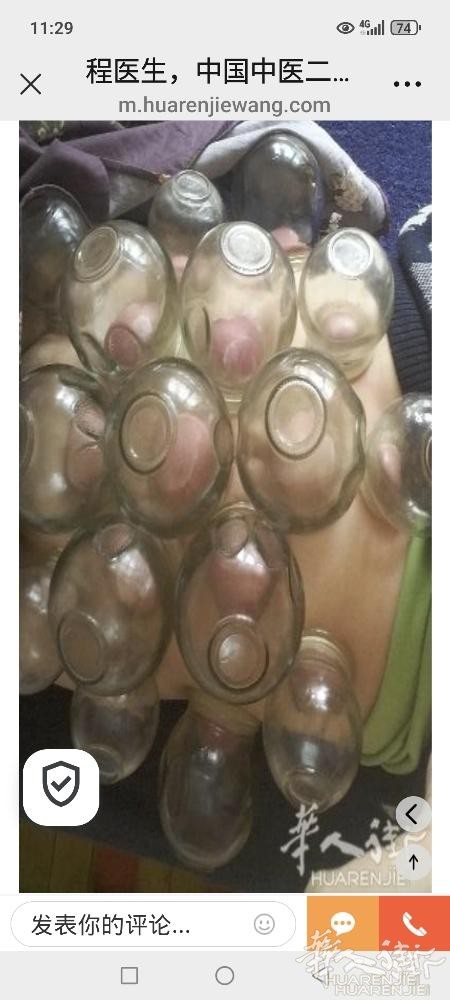 程医生，中国中医三十多年针灸理疗，主治 中风偏瘫，失眠，抑郁症，焦虑症，风湿性关