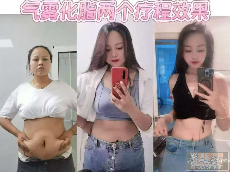 👍气雾化脂减肥💥今年特别火爆的减肥项目  专门解决嘴馋控制不住嘴的人 随便吃