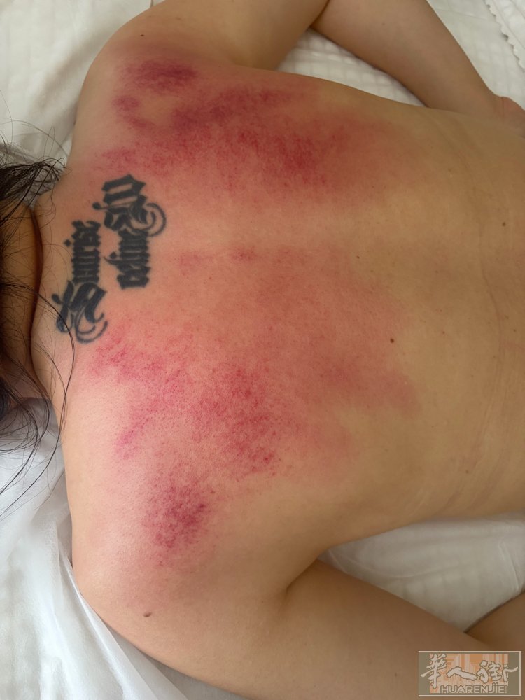 本人女，做美业10余年，专业美容美体，皮肤面部拨筋，身体亚健康调理，如肩颈疏通，