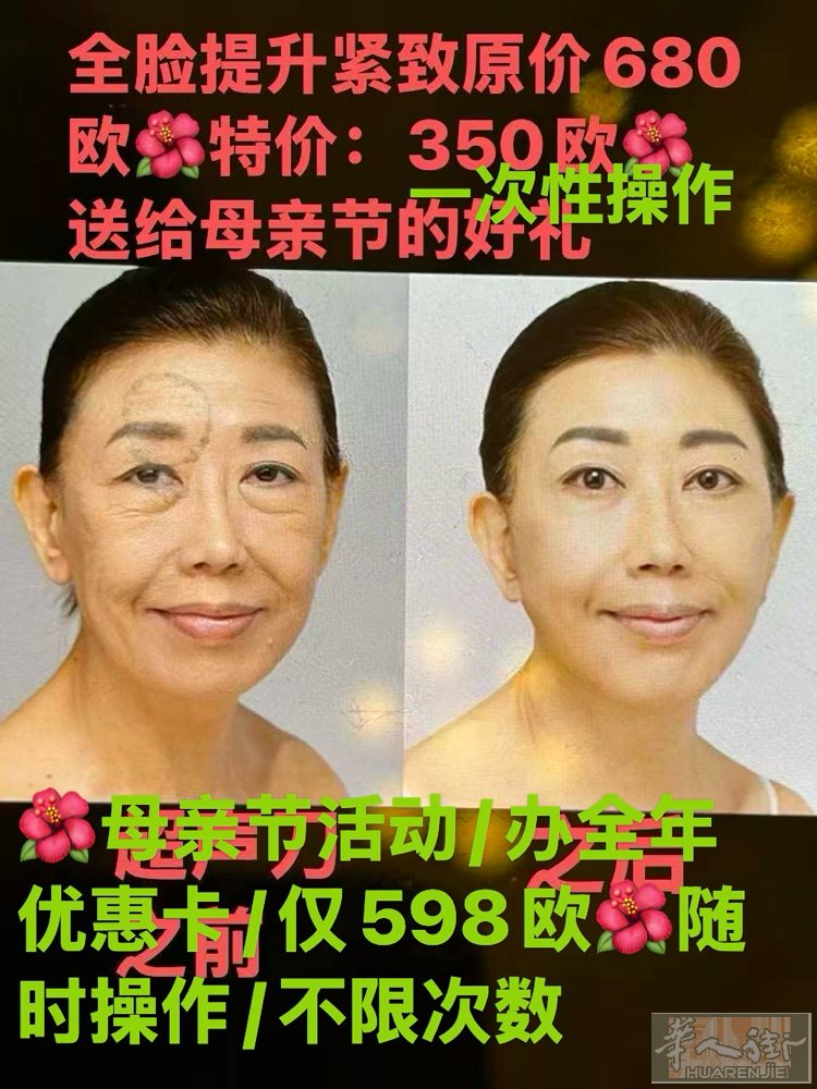 🌺5月母亲节特别献礼🌺  🌳原价一次性操作698欧 🌳优惠全年卡/598