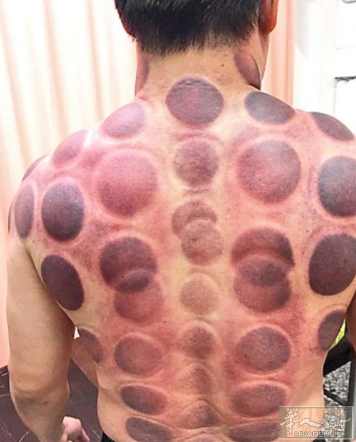 本人提供专业中医推拿、足疗、拔罐、刮痧、头疗等 缓解颈椎病、腰脱、坐骨神经痛、腿