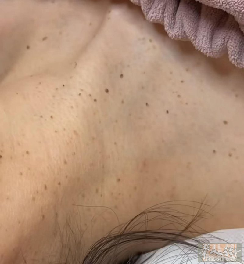 本人女，在中国做美业10余年，专注专业美容护肤，身体亚健康调理，如肩颈疏通，背部