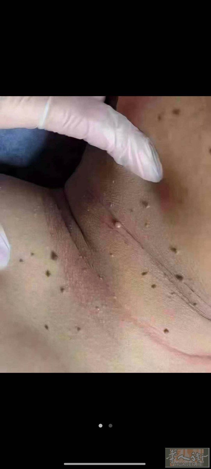 本人女，做美业10余年，专业调理皮肤和身体亚健康等问题，如背部三焦排毒，腿部按摩