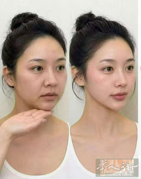 服务项目有；去皱、瘦脸，瘦肩，瘦腿，水光针，填充法令 纹，填充泪沟，填充鼻子，嘟