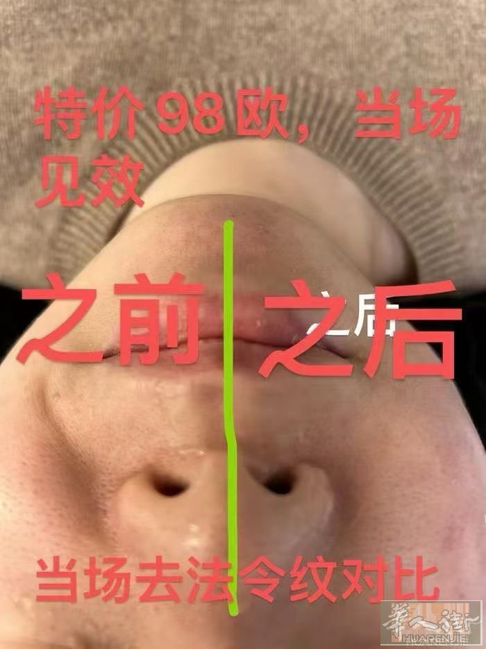 🌺6月特别献礼🌺  🌳原价一次性操作698欧 🌳优惠全年卡/598欧/3