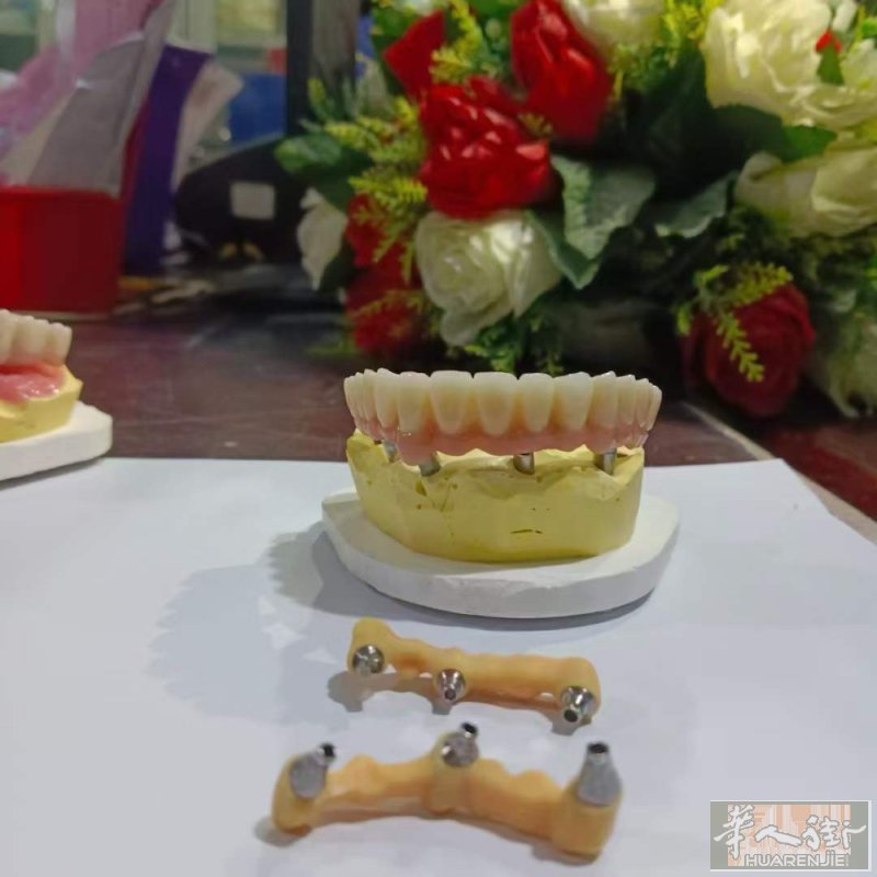 镶牙，治疗，补牙，活动牙，美白洁牙，口腔溃疡，牙好一切都好，扫⬇️微咨询～