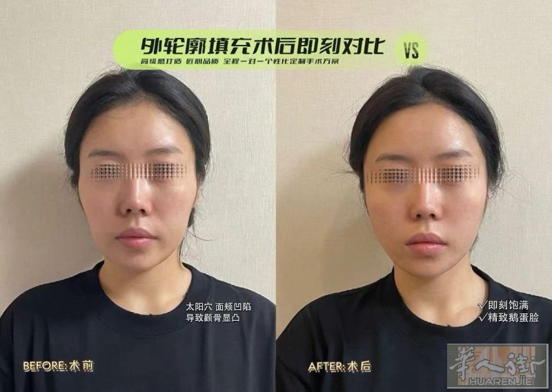 医疗美容整形 高端皮肤管理 针剂美容注射 有需要的宝宝们可以联系预约！微信LiA