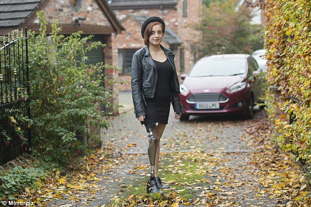 英独腿女孩被告知因残疾程度不够无资格用救济车