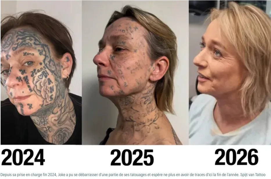 荷兰女子被前伴侣强迫在全身和脸上纹下其名字250多次，如今公开发声推动“洗纹身援助”